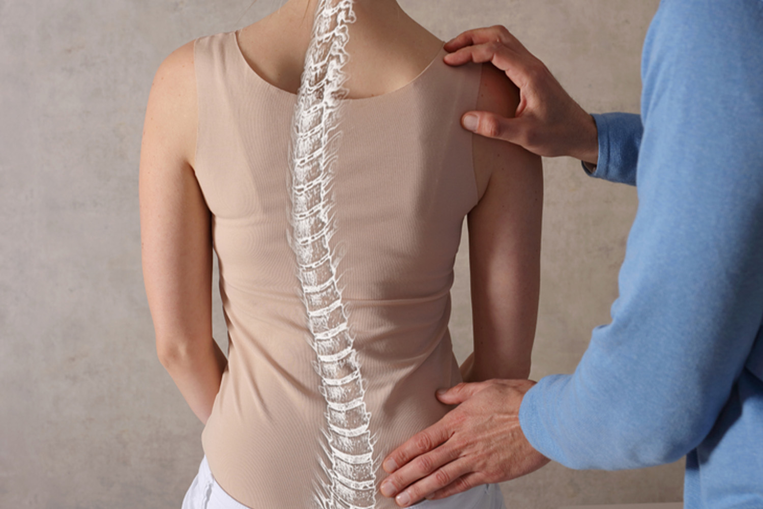Cervical Spondylosis