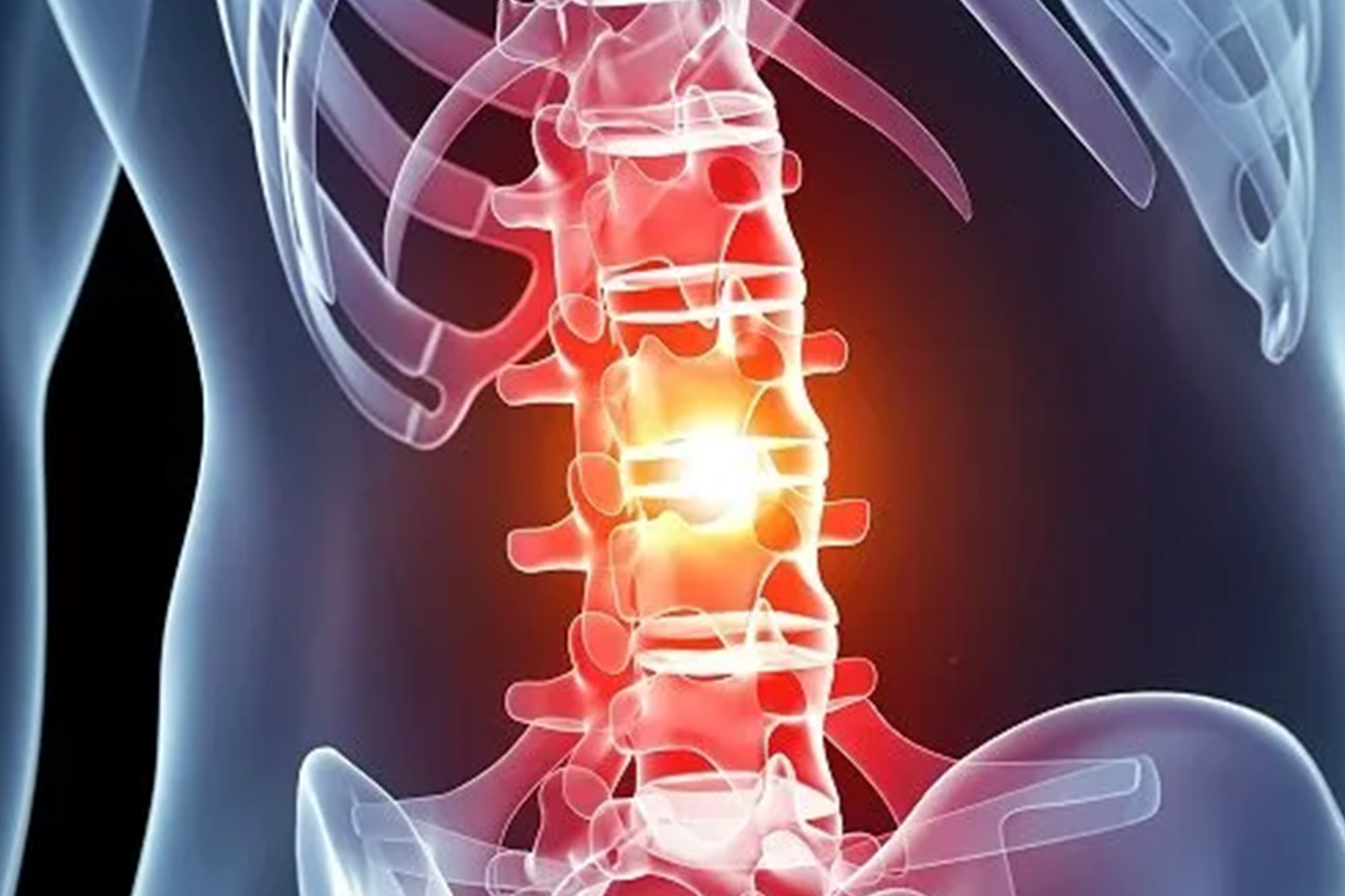 Spinal Cord Injury (SCI)