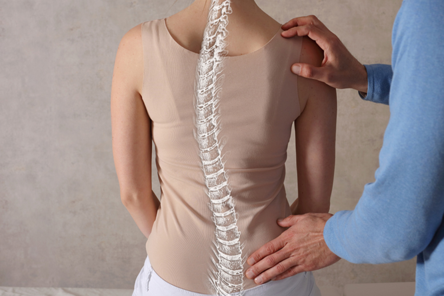 Spinal Deformities